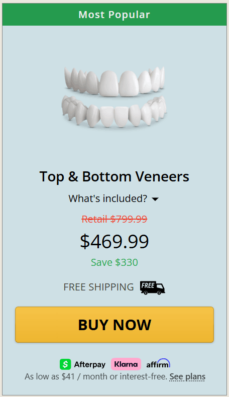 Shiny Smile Veneers 9